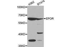 Western blot analysis of extracts of various cell lines, using EPOR antibody. (EPOR Antikörper  (AA 274-508))