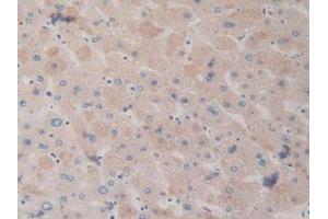IHC-P analysis of Human Liver Tissue, with DAB staining. (Dopamine Receptor d1 Antikörper  (AA 338-446))