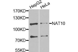 Western blot analysis of extracts of various cells, using NAT10 antibody. (NAT10 Antikörper)