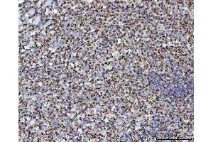 IHC analysis of MFF using anti-MFF antibody (ABIN7599292).