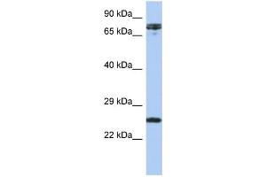 WB Suggested Anti-HNF1A Antibody Titration:  0. (HNF1A Antikörper  (N-Term))