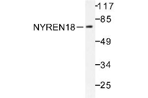 Image no. 1 for anti-Negative Regulator of Ubiquitin-Like Proteins 1 (NUB1) antibody (ABIN271950) (NUB1 Antikörper)