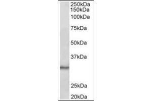 Staining of Mouse Testis lysate (35µg protein in RIPA buffer) using CTDSP1 antibody at 0. (CTDSP1 Antikörper  (Internal Region))