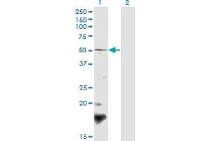 Western Blot analysis of BSCL2 expression in transfected 293T cell line by BSCL2 polyclonal antibody (A02). (BSCL2 Antikörper  (AA 263-354))