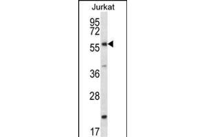 FOXJ3 Antibody (N-term) (ABIN657277 and ABIN2846366) western blot analysis in Jurkat cell line lysates (35 μg/lane). (FOXJ3 Antikörper  (N-Term))