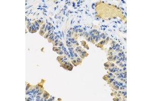 Immunohistochemistry of paraffin-embedded mouse lung using ANGPT1 antibody (ABIN5974767) at dilution of 1/100 (40x lens).