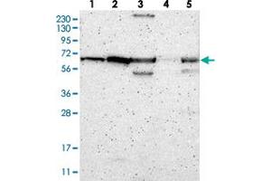 Western blot analysis of Lane 1: RT-4, Lane 2: U-251 MG, Lane 3: Human Plasma, Lane 4: Liver, Lane 5: Tonsil with ME2 polyclonal antibody  at 1:250-1:500 dilution. (NAD-ME Antikörper)