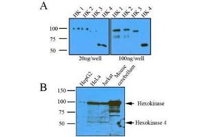 (A): Recombinant protein (20ng or 100ng) of Hexokinase four isoform were resolved by SDS-PAGE, transferred to nitrocellulose membrane and probed with anti-human Hexokinase (1:1000). (Hexokinase Antikörper  (AA 1-917))