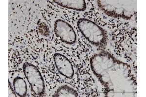 Image no. 1 for anti-CD3e Molecule, epsilon Associated Protein (CD3EAP) (AA 2-111) antibody (ABIN599522) (CD3EAP Antikörper  (AA 2-111))
