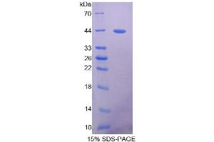 Image no. 1 for Platelet-Derived Growth Factor Receptor-Like (PDGFRL) (AA 22-375) protein (His tag) (ABIN6236938)