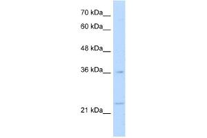 WB Suggested Anti-MAFB Antibody Titration:  1. (MAFB Antikörper  (N-Term))