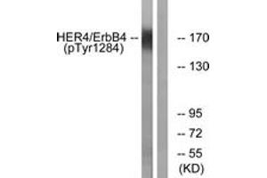 Western blot analysis of extracts from HuvEc cells treated with EGF 200ng/ml 30', using HER4 (Phospho-Tyr1284) Antibody. (ERBB4 Antikörper  (pTyr1284))
