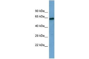 Western Blotting (WB) image for anti-Sestrin 1 (SESN1) (Middle Region) antibody (ABIN2786032) (SESN1 Antikörper  (Middle Region))