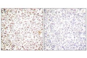 Immunohistochemical analysis of paraffin-embedded human lymph node tissue using OCT-1 antibody (ABIN5976471).