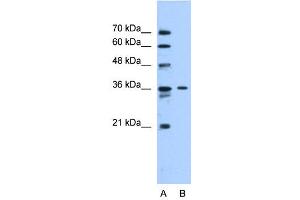 Western Blotting (WB) image for anti-Solute Carrier Family 35 (UDP-N-Acetylglucosamine (UDP-GlcNAc) Transporter), Member A3 (SLC35A3) (Middle Region) antibody (ABIN2781628)
