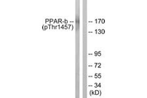 Western blot analysis of extracts from HuvEc cells treated with Serum 20% 30', using PPAR-BP (Phospho-Thr1457) Antibody. (PPAR-BP (AA 1423-1472), (pThr1457) Antikörper)