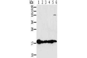 Gel: 10 % SDS-PAGE, Lysate: 40 μg, Lane 1-6: Mouse heart tissue, Mouse muscle tissue, hela cells, mouse liver tissue tissue, mouse kidney tissue, hepg2 cells, Primary antibody: ABIN7130290(MTFP1 Antibody) at dilution 1/450, Secondary antibody: Goat anti rabbit IgG at 1/8000 dilution, Exposure time: 5 seconds