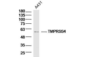 Lane 1: A431 lysates probed with TMPRSS4 Polyclonal Antibody, Unconjugated  at 1:300 overnight at 4˚C. (TMPRSS4 Antikörper  (AA 84-130))