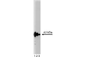 Western Blotting (WB) image for anti-p62 Lck Ligand (AA 257-437) antibody (ABIN968203) (p62 Lck Ligand (AA 257-437) Antikörper)