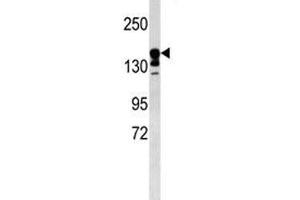 ABCC9 antibody western blot analysis in mouse kidney tissue lysate. (ABCC9 Antikörper  (AA 640-669))