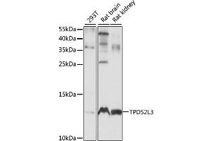 Western blot analysis of extracts of various cell lines, using TPD52L3 antibody (ABIN7271078) at 1:1000 dilution.