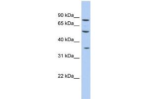 WB Suggested Anti-FAM63A Antibody Titration: 0. (FAM63A Antikörper  (Middle Region))