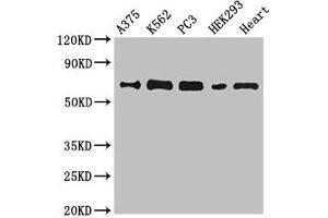 Western Blot Positive WB detected in: A375 whole cell lysate, K562 whole cell lysate, PC-3 whole cell lysate, HEK293 whole cell lysate, Mouse heart tissue All lanes: GBP2 antibody at 6.