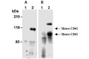 Western Blotting (WB) image for anti-Integrin beta 3 (ITGB3) antibody (ABIN1449278) (Integrin beta 3 Antikörper)
