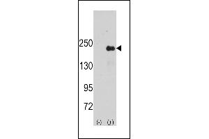 Western blot analysis of SG9 (arrow) using rabbit polyclonal SG9 Antibody (Center) (ABIN391447 and ABIN2841430). (SPAG9 Antikörper  (AA 603-632))