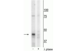Western blot of mouse mitochondria from whole brain lysate showing specific immunolabeling of the ~46 kDa CK1Mt protein phosphorylated at Tyr153 in the first lane (-). (CKMT1A Antikörper  (pTyr153))