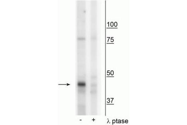 CKMT1A antibody  (pTyr153)