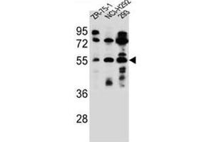 Western blot analysis of FUT6 Antibody (N-term) in ZR-75-1, NCI-H292, 293 cell line lysates (35ug/lane).