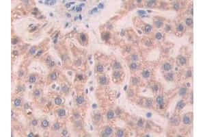Immunohistochemistry (IHC) image for anti-Slit Homolog 1 (SLIT1) (AA 308-512) antibody (ABIN7438097)