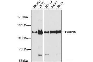 Western blot analysis of extracts of various cell lines using PARP10 Polyclonal Antibody at dilution of 1:3000. (PARP10 Antikörper)