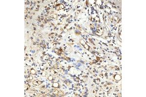 IHC analysis of SPTBN2 using anti-SPTBN2 antibody (ABIN7602111).