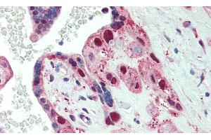 Detection of SPTbN4 in Human Placenta Tissue using Polyclonal Antibody to Spectrin Beta, Non Erythrocytic 4 (SPTbN4) (SPTBN4 Antikörper  (AA 64-285))