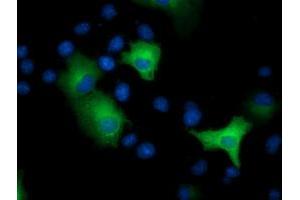 Anti-EPHX2 mouse monoclonal antibody (ABIN2452992) immunofluorescent staining of COS7 cells transiently transfected by pCMV6-ENTRY EPHX2 (RC202489). (EPHX2 Antikörper)