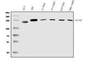 anti-Protein Phosphatase 4, Regulatory Subunit 1 (PPP4R1) (C-Term) antibody