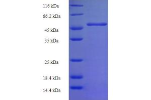 SDS-PAGE (SDS) image for Geranylgeranyl Diphosphate Synthase 1 (GGPS1) (AA 1-300), (full length) protein (His-SUMO Tag) (ABIN5709575) (GGPS1 Protein (AA 1-300, full length) (His-SUMO Tag))