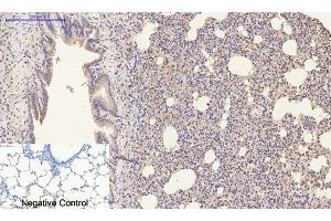 Immunohistochemical analysis of paraffin-embedded rat lung tissue. (Luciferase Antikörper)