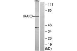 Western Blotting (WB) image for anti-Interleukin-1 Receptor-Associated Kinase 3 (IRAK3) (AA 491-540) antibody (ABIN2889831) (IRAK3 Antikörper  (AA 491-540))