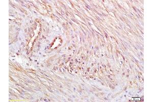Immunohistochemistry (IHC) image for anti-Endothelin Receptor Type B (EDNRB) (AA 31-130) antibody (ABIN679973)