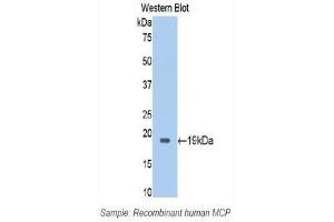 Western Blotting (WB) image for anti-CD46 (CD46) (AA 147-285) antibody (ABIN1174444) (CD46 Antikörper  (AA 147-285))