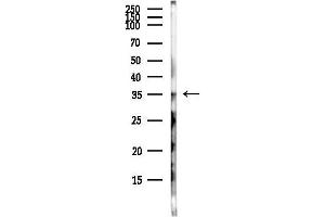 anti-Single Stranded DNA Binding Protein 3 (SSBP3) antibody