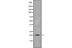 Western blot analysis of MED30 using MCF7 whole cell lysates