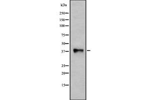 Western Blotting (WB) image for anti-Purinergic Receptor P2Y, G-Protein Coupled, 10 (P2RY10) (Internal Region) antibody (ABIN6263948)