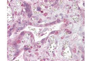 Anti-NFATC4 antibody IHC of human placenta. (NFATC4 Antikörper  (AA 953-965))