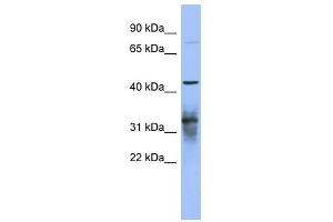 PABPC5 antibody used at 1 ug/ml to detect target protein.