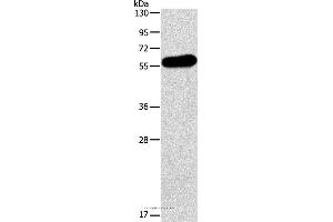 Western blot analysis of Human testis tissue, using APOH Polyclonal Antibody at dilution of 1:275 (APOH Antikörper)