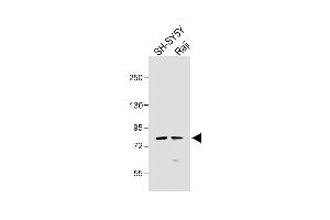 All lanes : Anti-K5 Antibody at 1:1000 dilution Lane 1: SH-SY5Y whole cell lysate Lane 2: Raji whole cell lysate Lysates/proteins at 20 μg per lane. (PAK7 Antikörper  (AA 168-198))